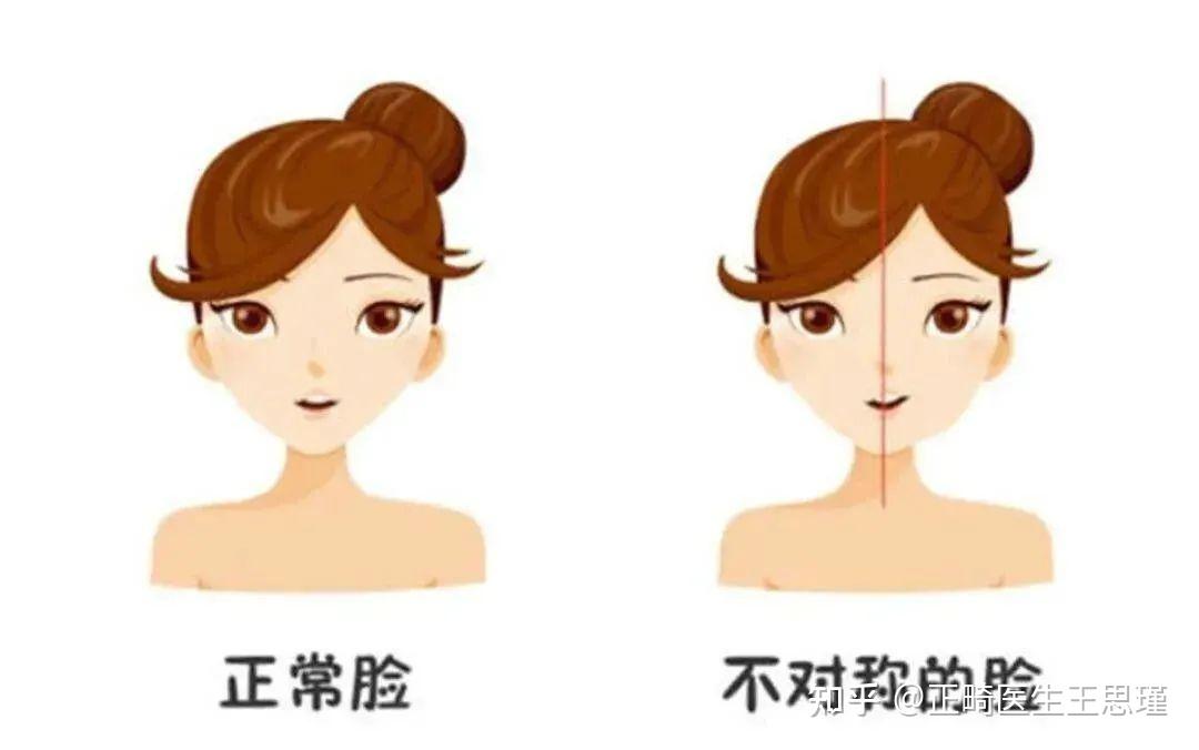 吃饭总咬腮帮子就是上火?或是这几件事引起的! - 知乎