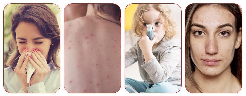 除螨喷雾有用吗 21除螨喷雾哪个好 除螨喷雾有毒吗 好用的除螨喷雾推荐 知乎