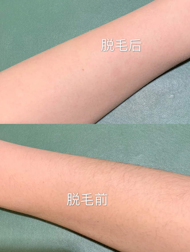 价大约1749人民币,可以点击链接看看详情考虑入手~相比起用一些脱毛膏