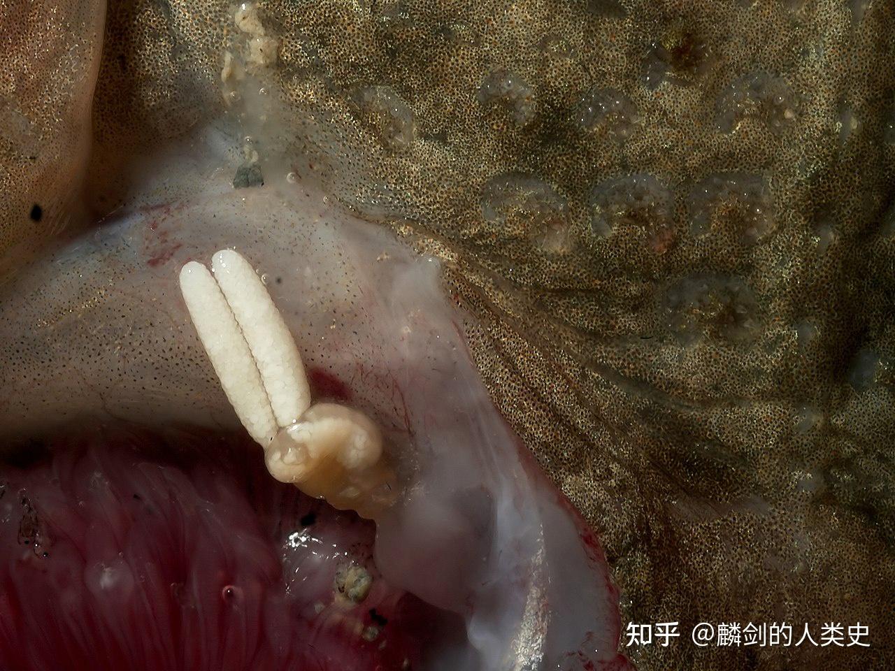 【动物界全系列】剑水蚤目—软刺鱼蚤科