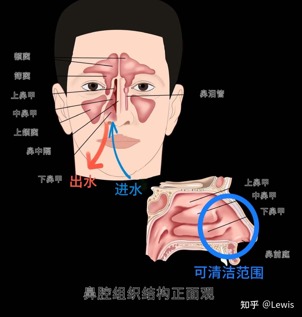 2025洗鼻器选购攻略:手动vs电动,喷雾vs水流,到底哪种更值得买?