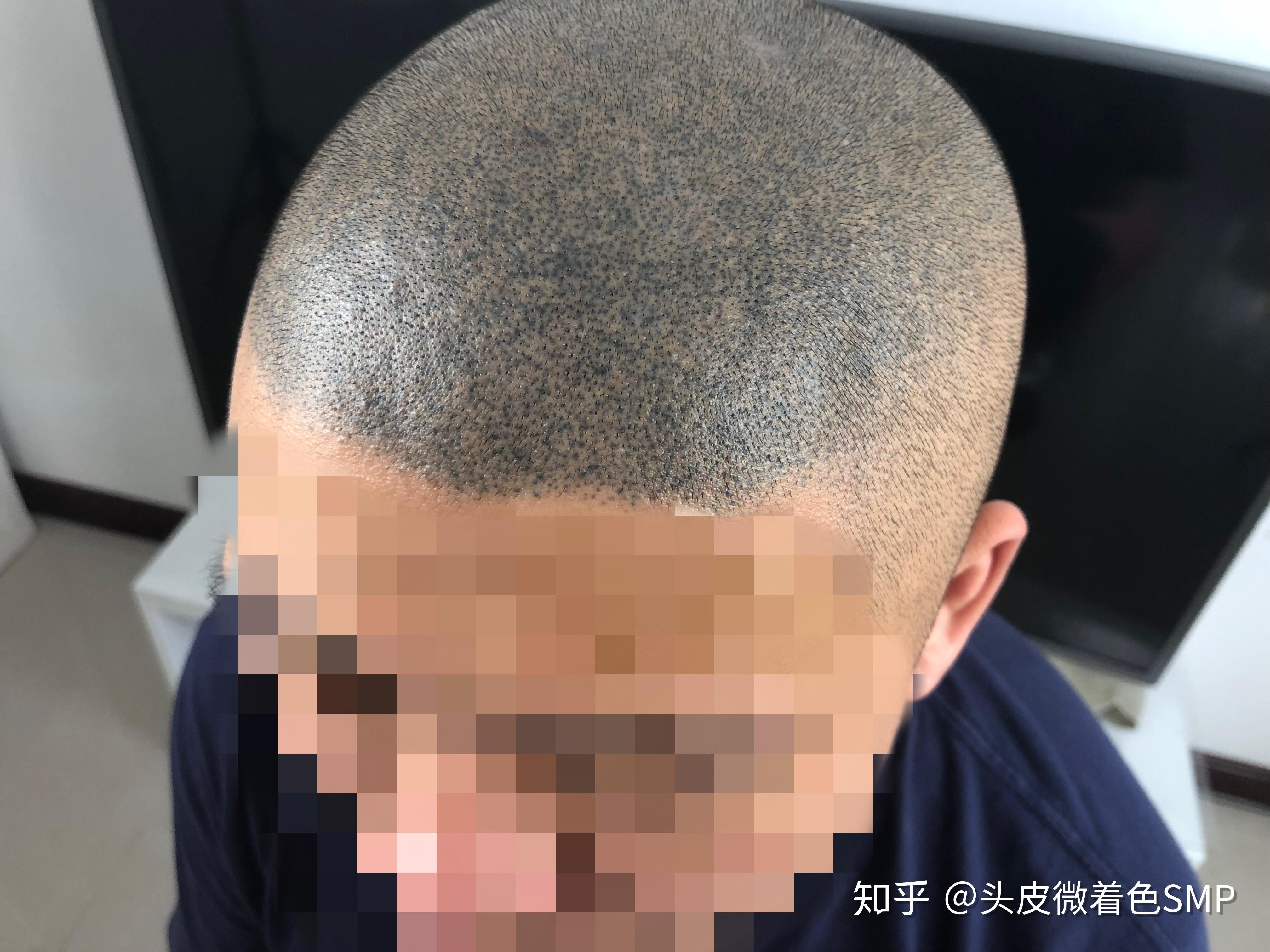 纹发老师亲身经历告诉你什么是合格的纹发？ - 知乎