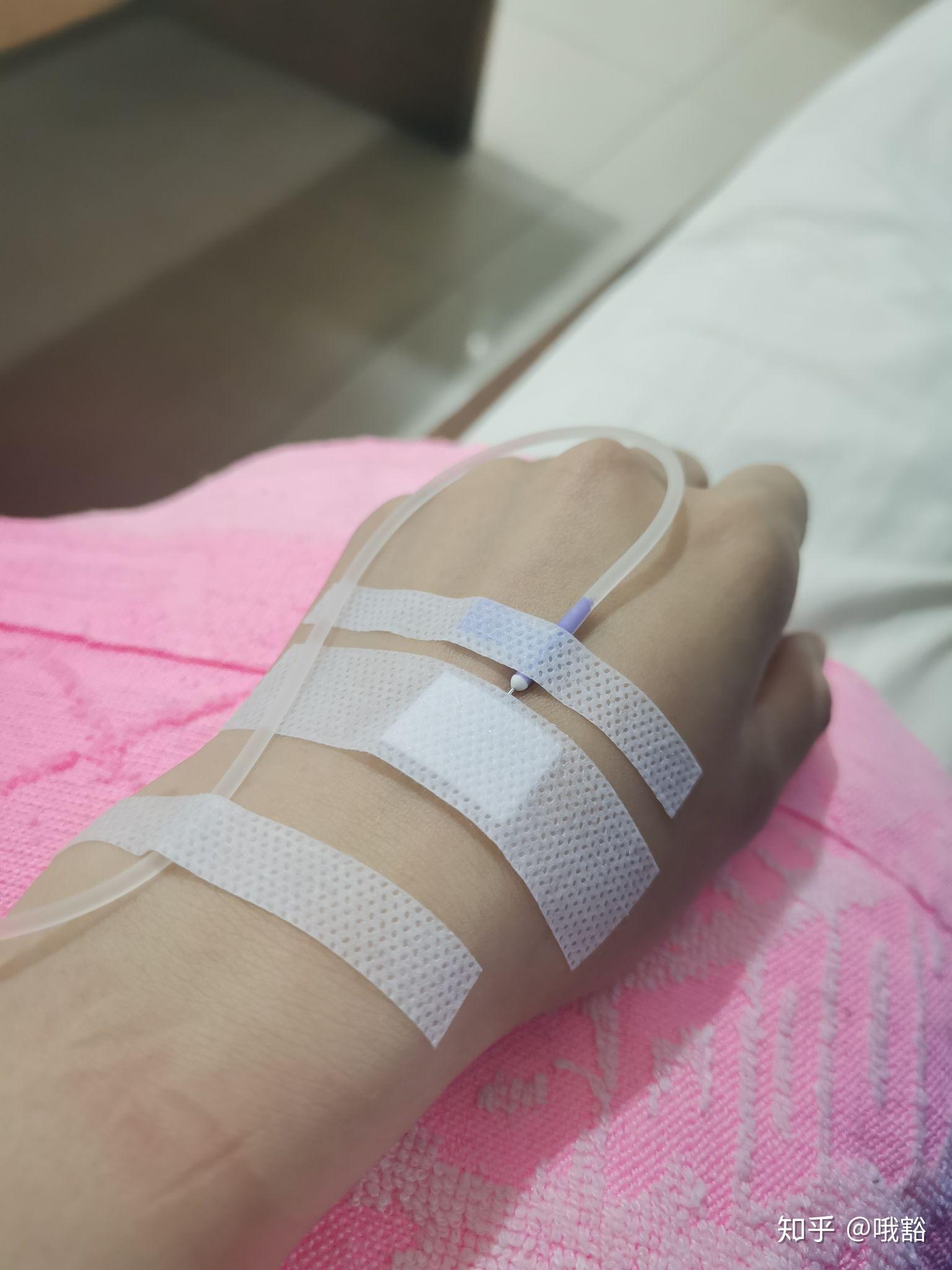 沉的,闭上眼就想睡,下午感觉有点低烧,喉咙还是很痛,现在来诊所吊点滴