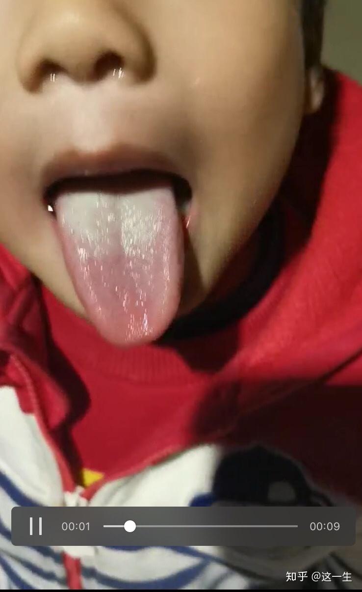 小孩子怎么补充阳气 v2-93968b69a1173a682b4c030d92eaa0ee_r.jpg