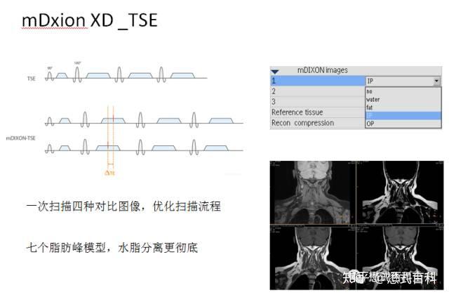 图13:飞利浦自旋回波dixon技术,mdixon-tse的原理及优势自旋回波dixon