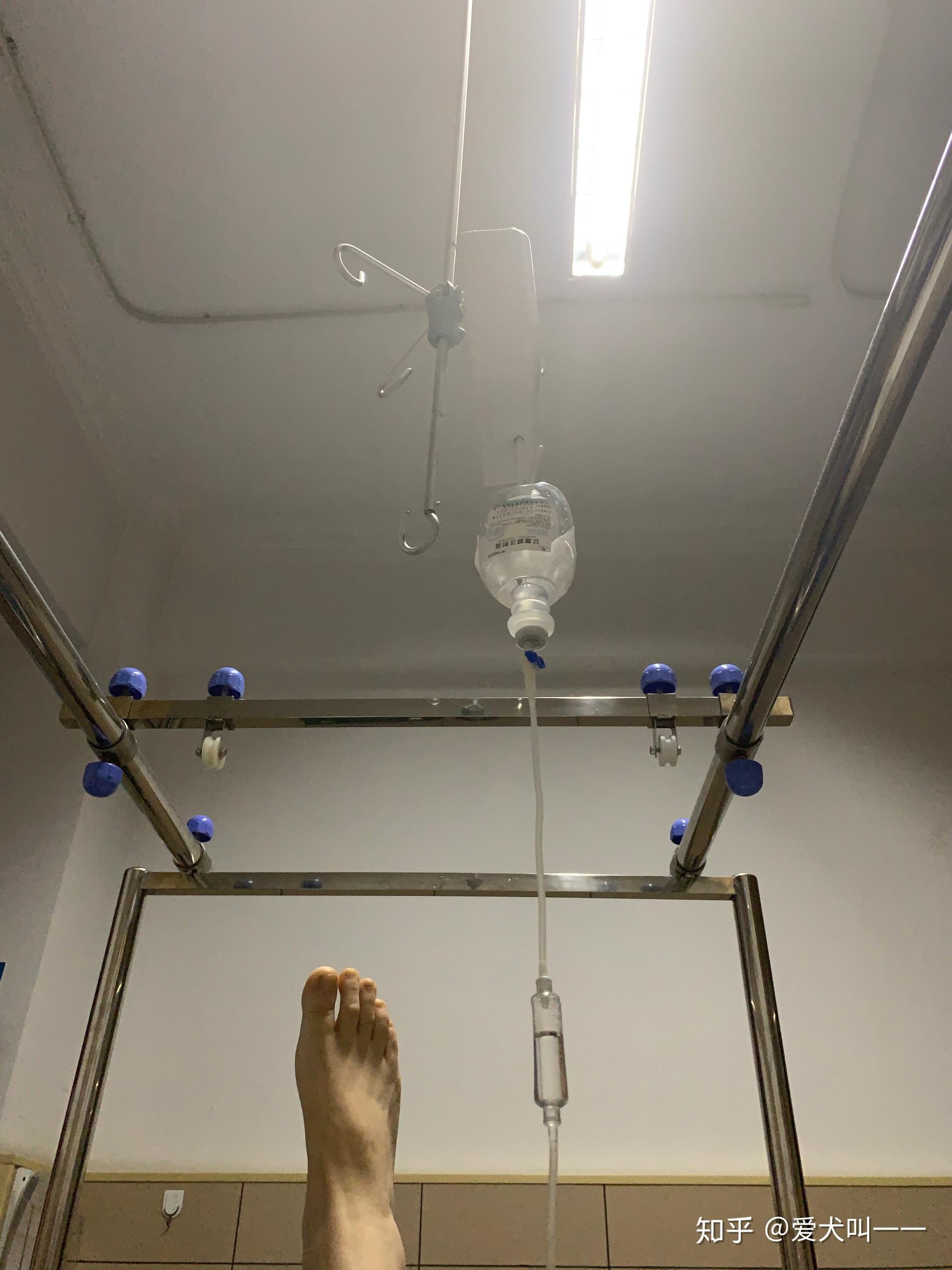 另外一只脚当天已经抬不起来了,输液了,消肿的,防止血栓的,一天五瓶