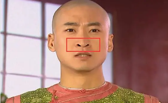 图片源自网络,侵删尔康这个鼻孔非常的有代表性了④鼻头鼻翼肥厚「这