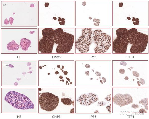 类器官免疫组化鉴定展示 - 知乎
