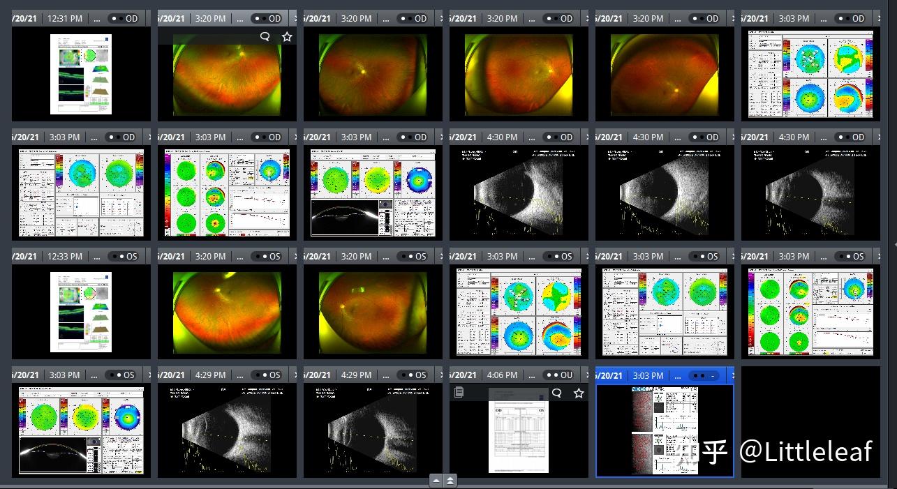 眼科OPD怎么读图希玛眼科医院再添“利器”助力屈光性白内障手术_https://www.jmylbn.com_新闻资讯_第4张