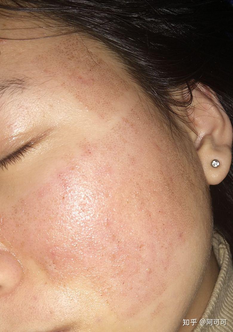 做点阵激光第五天