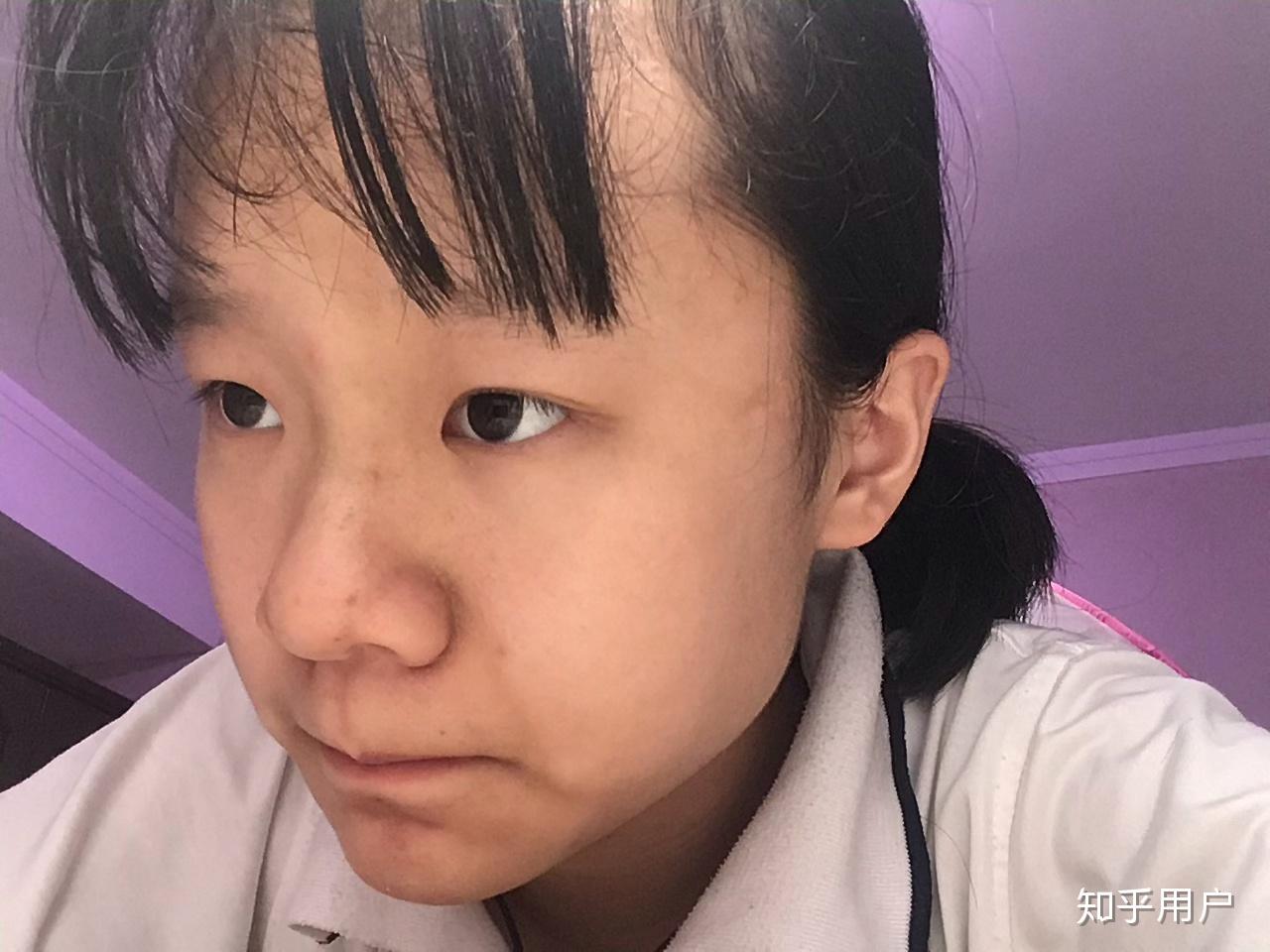 女生长得特别丑怎么办