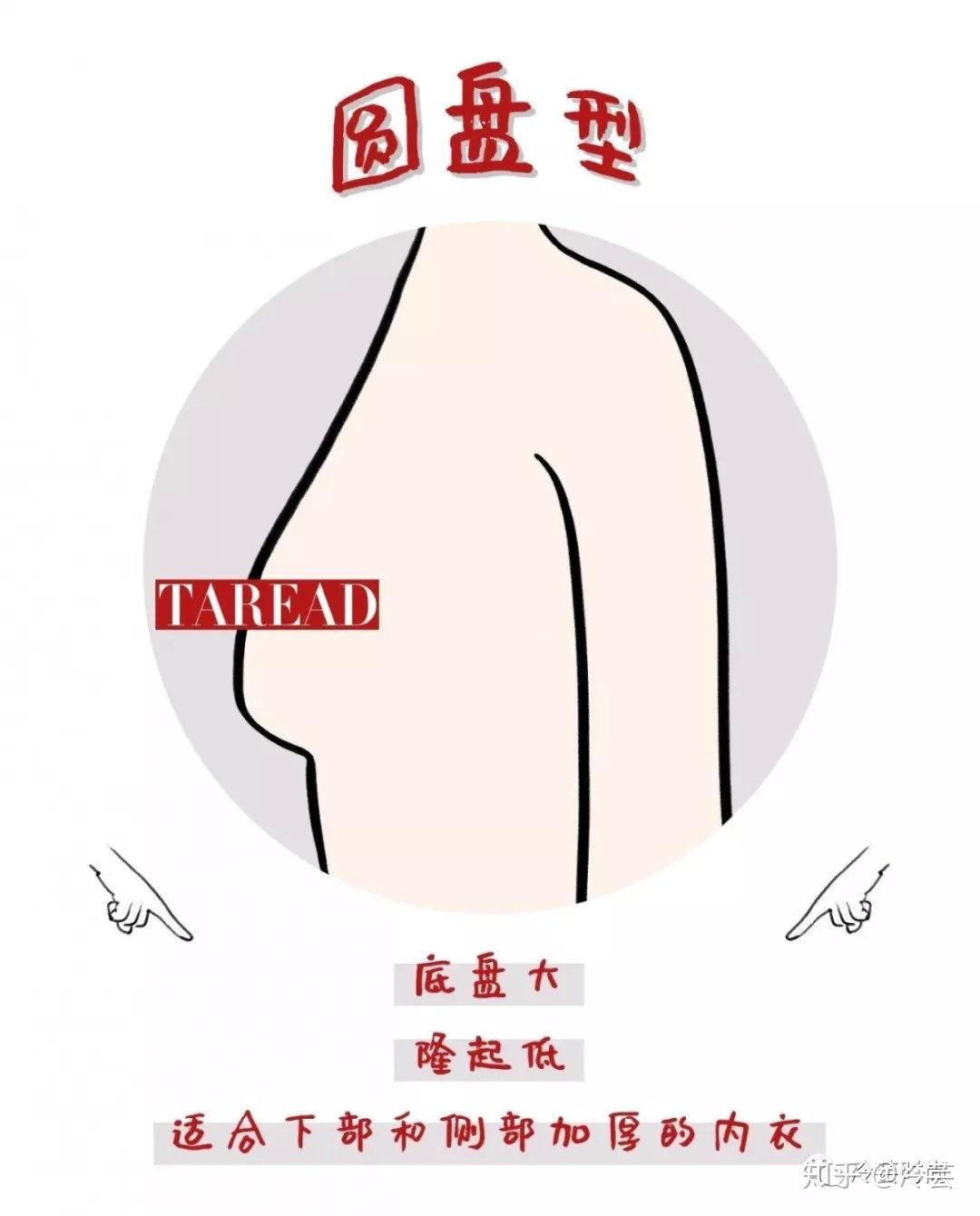 a,圆锥形 b,圆盘型 c,半球型d,纺锤型e,一大一小型f,外扩型g.