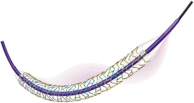 支架也并非新技术,美敦力 resolute onyx 药物洗脱支架 (des) 在左