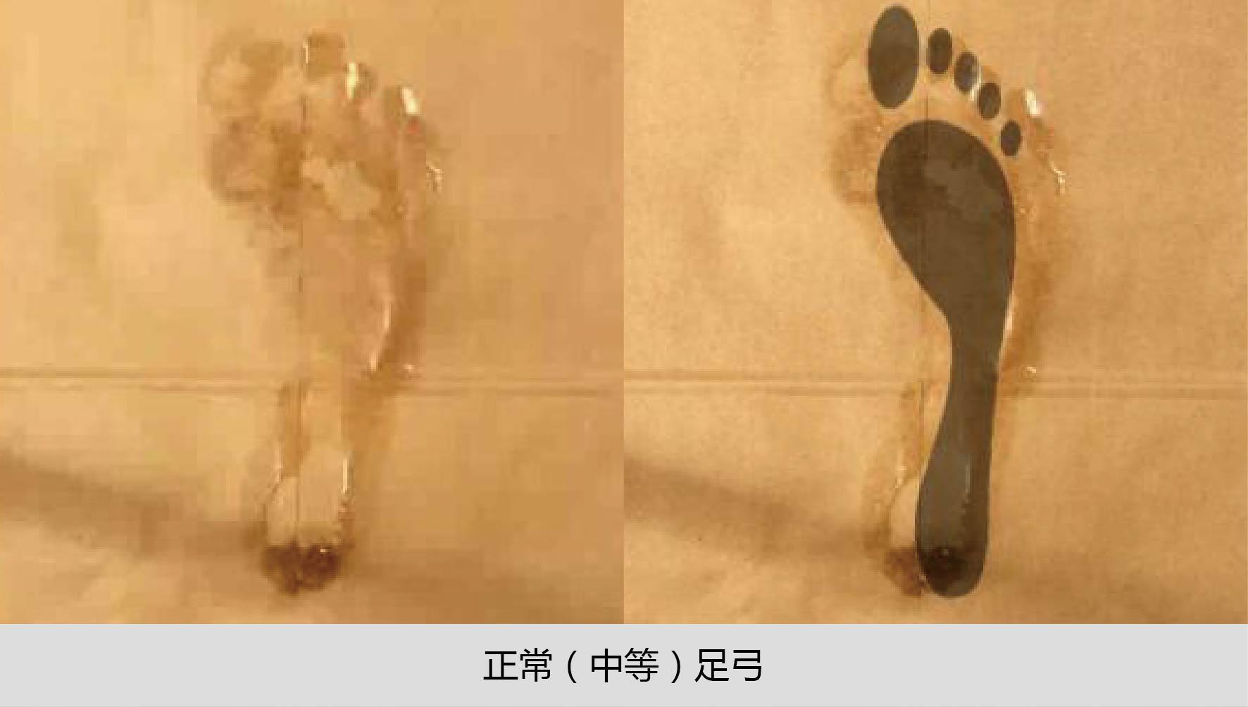当你看到脚印上有一半左右的足弓,那么恭喜你,说明你的脚型和小木博士