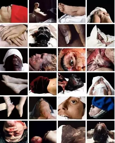 infectious pneumonia死于感染性肺炎homicide杀人罪在美国一间不知名