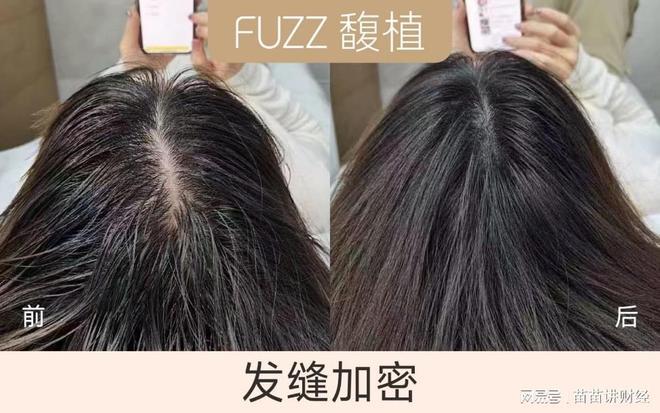 发缝宽怎么办?发缝大怎么改善? - 知乎