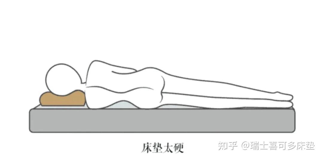 腰疼就睡硬板床？ - 知乎