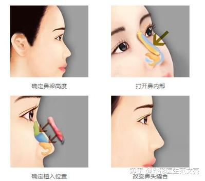 怎么样才能做到无菌操作 v2-94e76224480cc25b53a46682d6fb188e_b.jpg