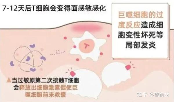 健康百科丨NONONO!春敏≠过敏! - 知乎