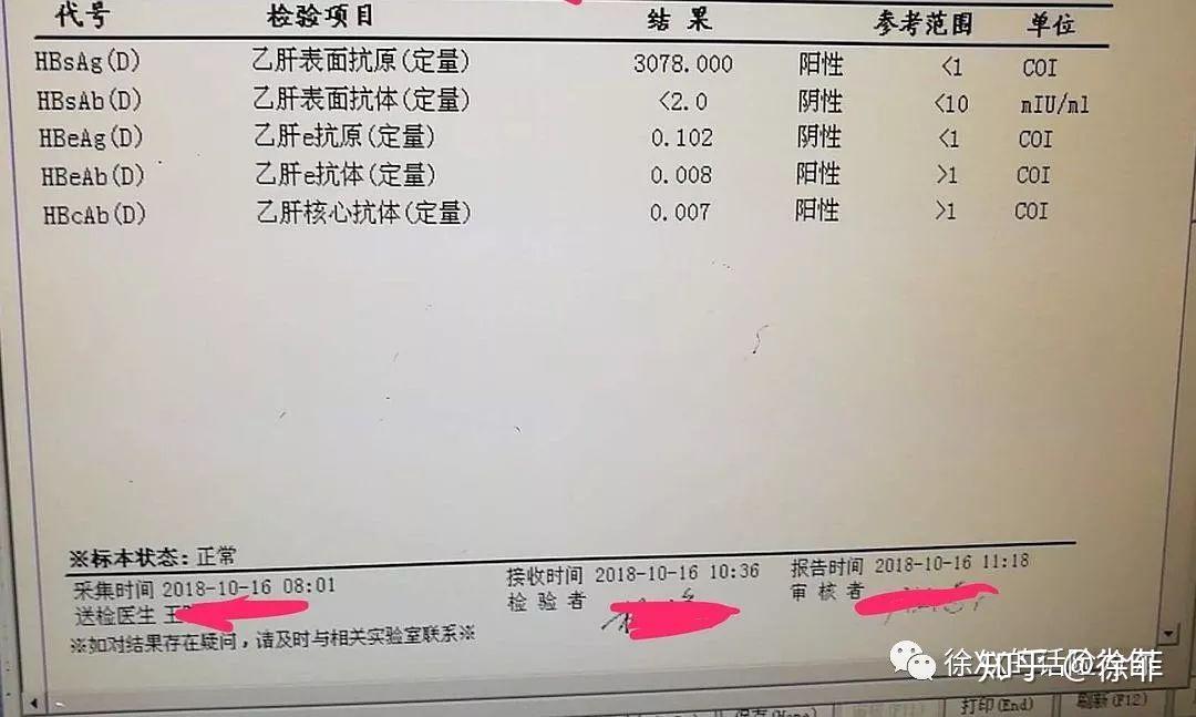 投保指南⑧關於乙肝病毒攜帶者小三陽大三陽肝炎