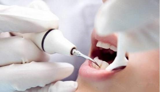 洗牙的好处:洗牙的流程:洁牙,俗称洗牙,专业术语龈上洁治术,是指用洁