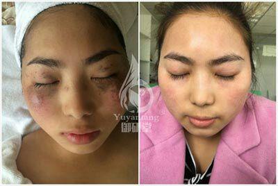 南京御妍堂祛斑效果真的这么好?