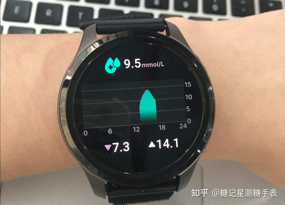 打工人实测糖记星测糖手表!常年奶茶外卖,终于摸清自己的身体规律
