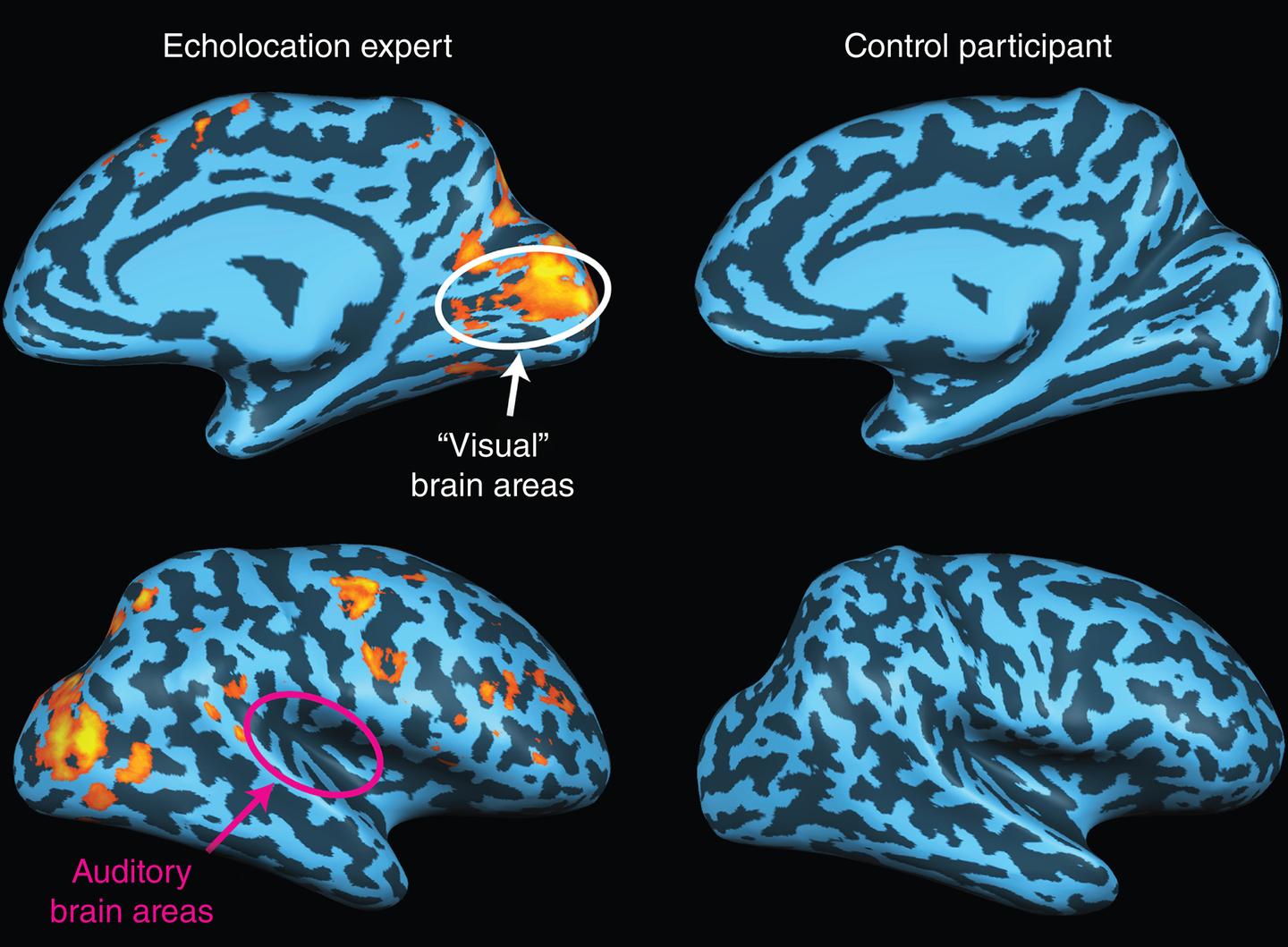 任何人都能在短短10周内学会回声定位——并重塑大脑Anyone Can Learn Echolocation in Just 10 Weeks ...