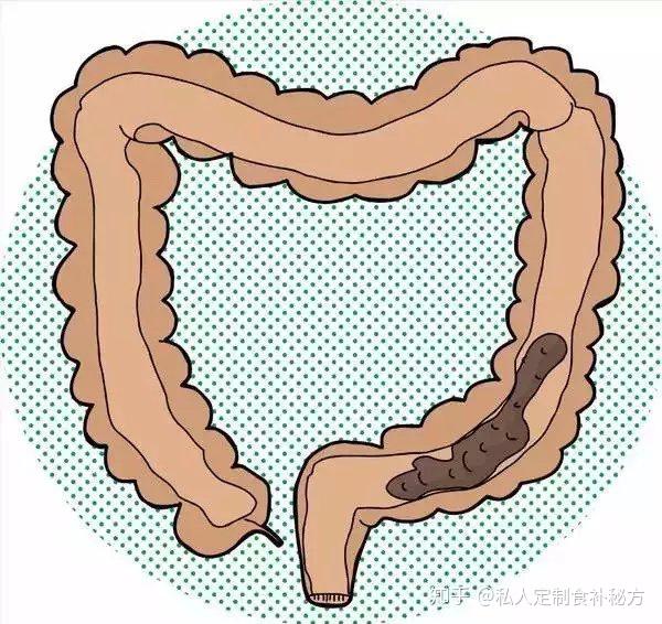 一个人肚子里的宿便到底有多少数字惊人