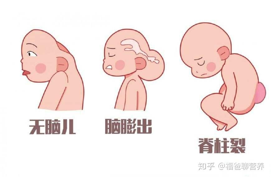 宝宝脑膜膨出图片图片