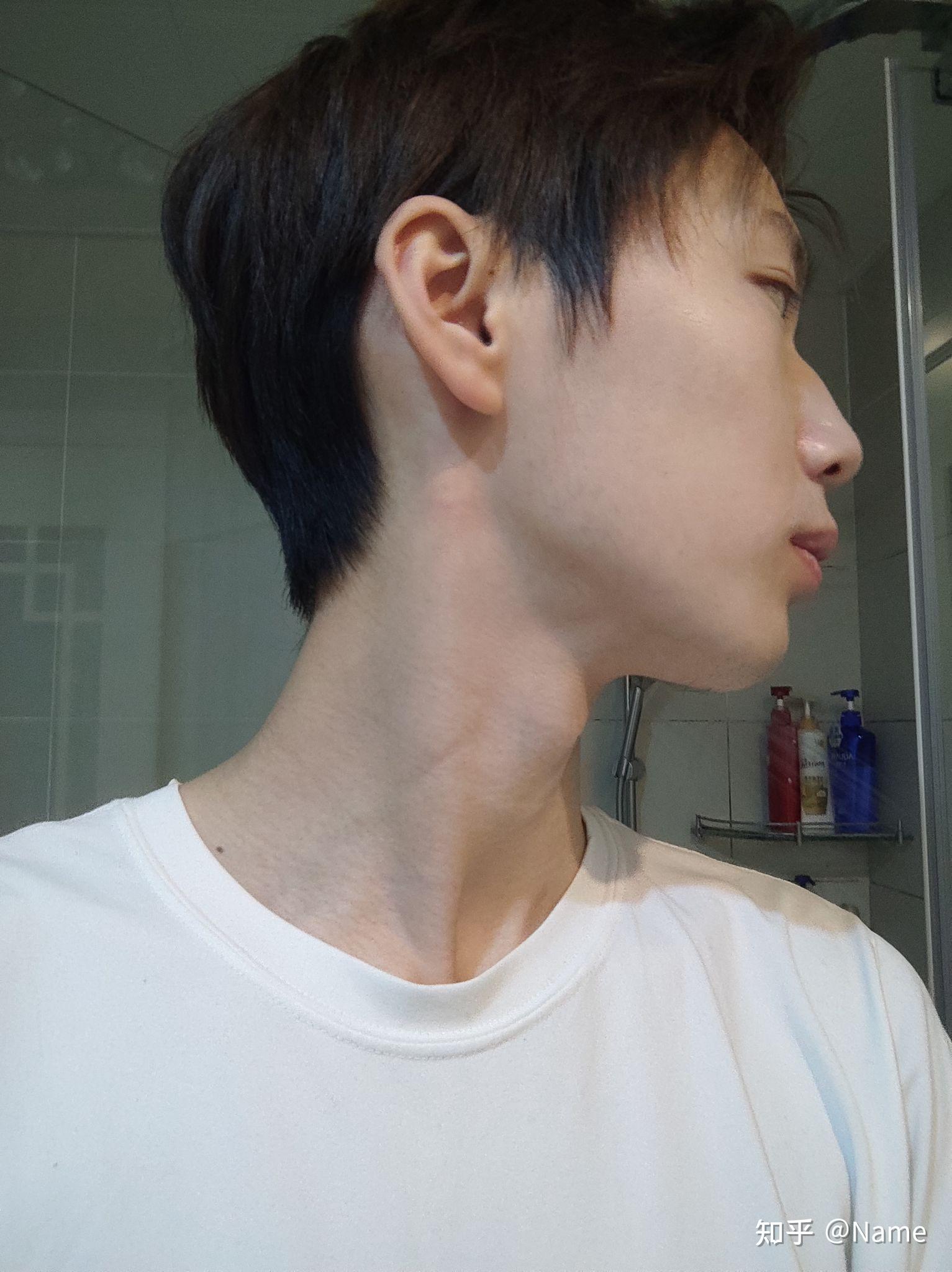 你见过塌鼻子的帅哥吗? - 知乎