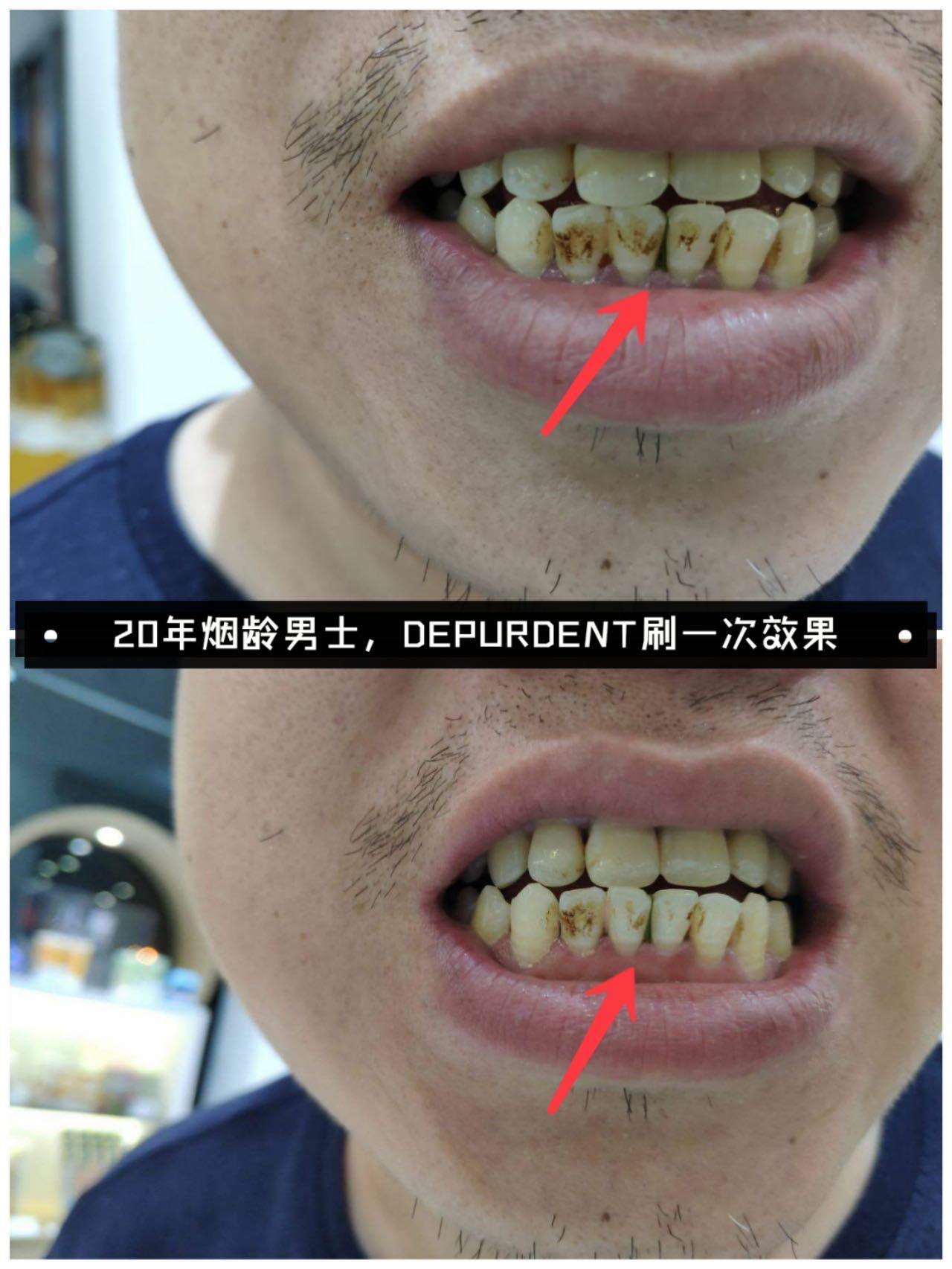 v2-95bbc414c423d351e0e5a3c22070aeca_r.jpg
