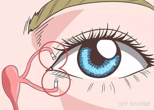 为什么眼睛总流眼泪?可能和这5种疾病有关,别大意! - 知乎