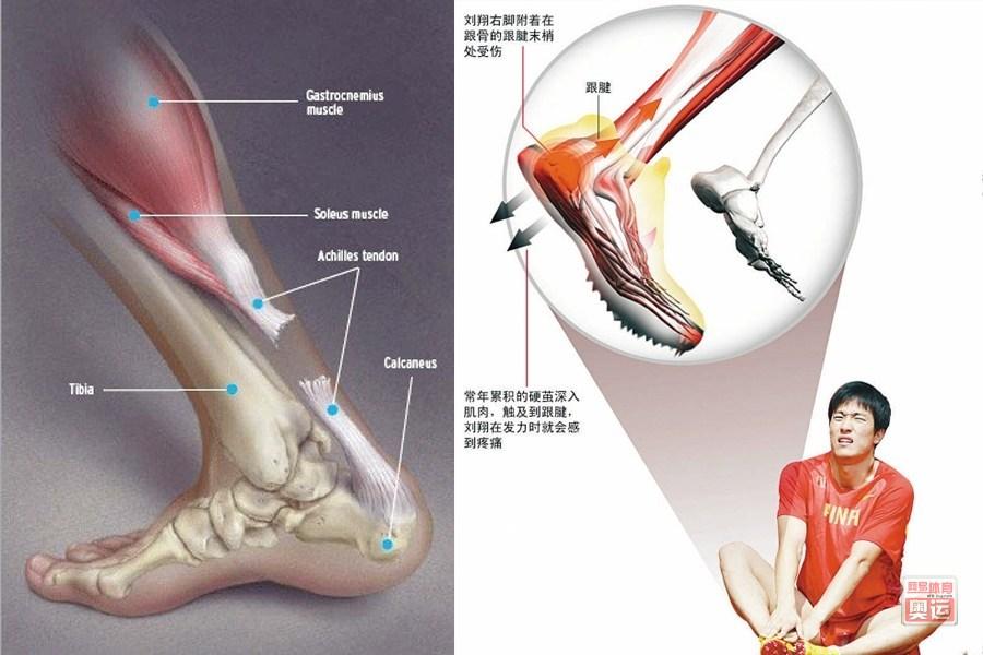 什么是韧带?在骨科领域,韧带是连接骨头和骨头之间的纤