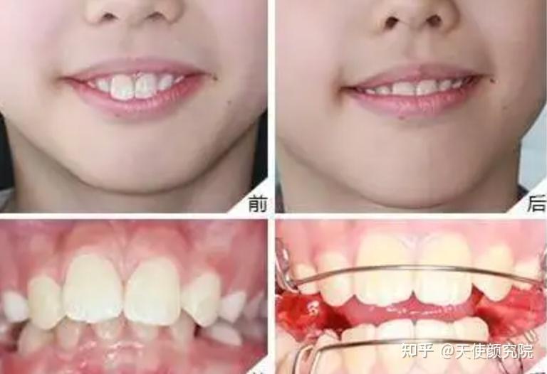 郑秀妍这段太蛊了吧!芒果台怎么能删了不播??!(郑秀妍签约英皇)