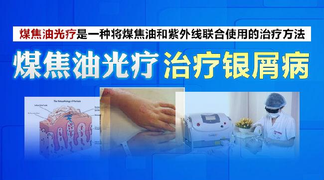 银屑病患者——为煤焦油打call!