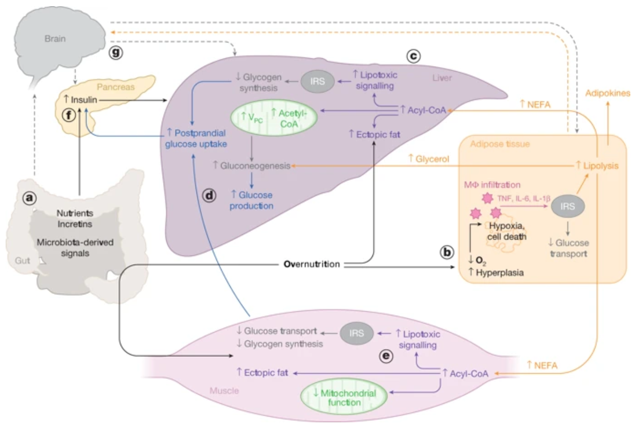糖尿病的发病机理是什么？ 知乎