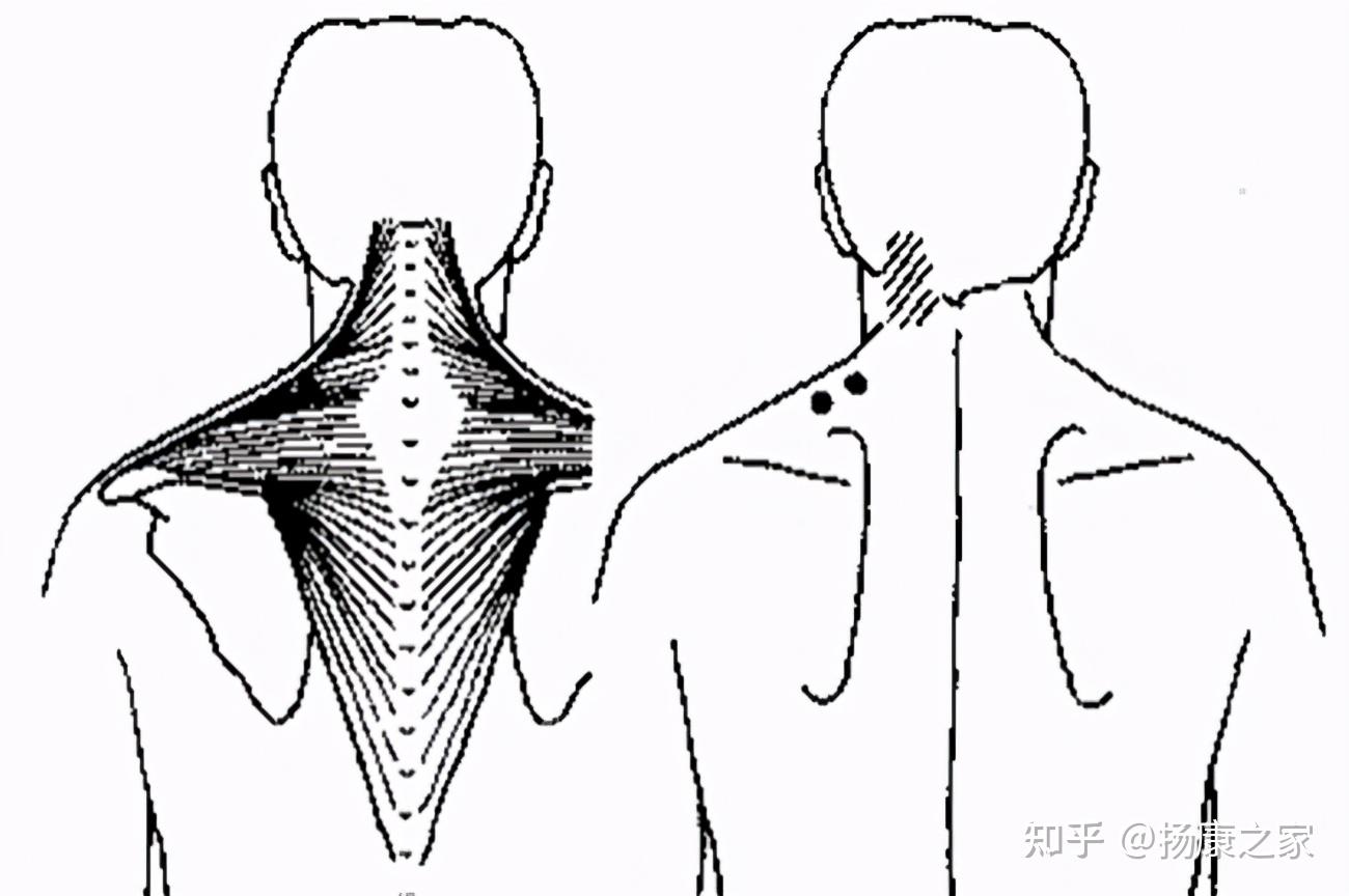 缓解颈椎肩膀疼痛的按摩方法之斜方肌的按摩方法