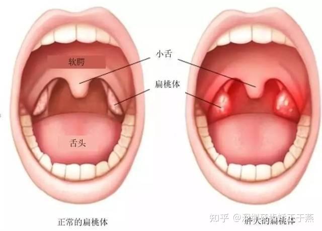 知乎