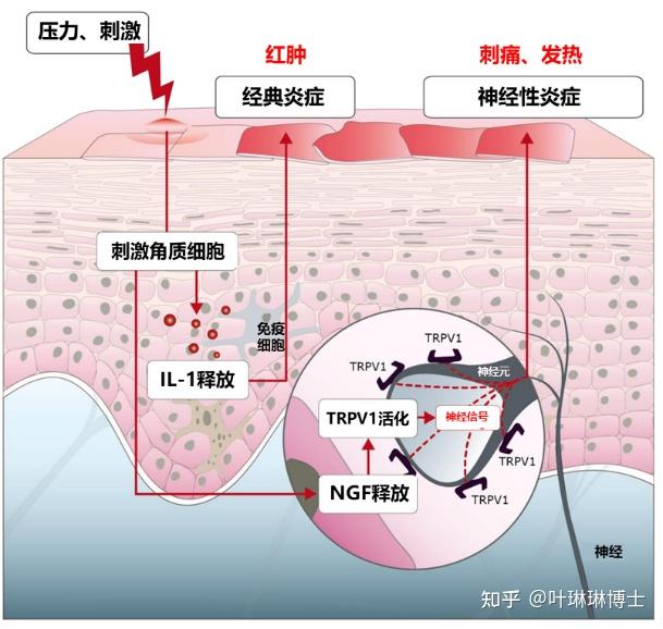 成分说丨皮肤“烧灼感”是一种怎样的经历？ - 知乎