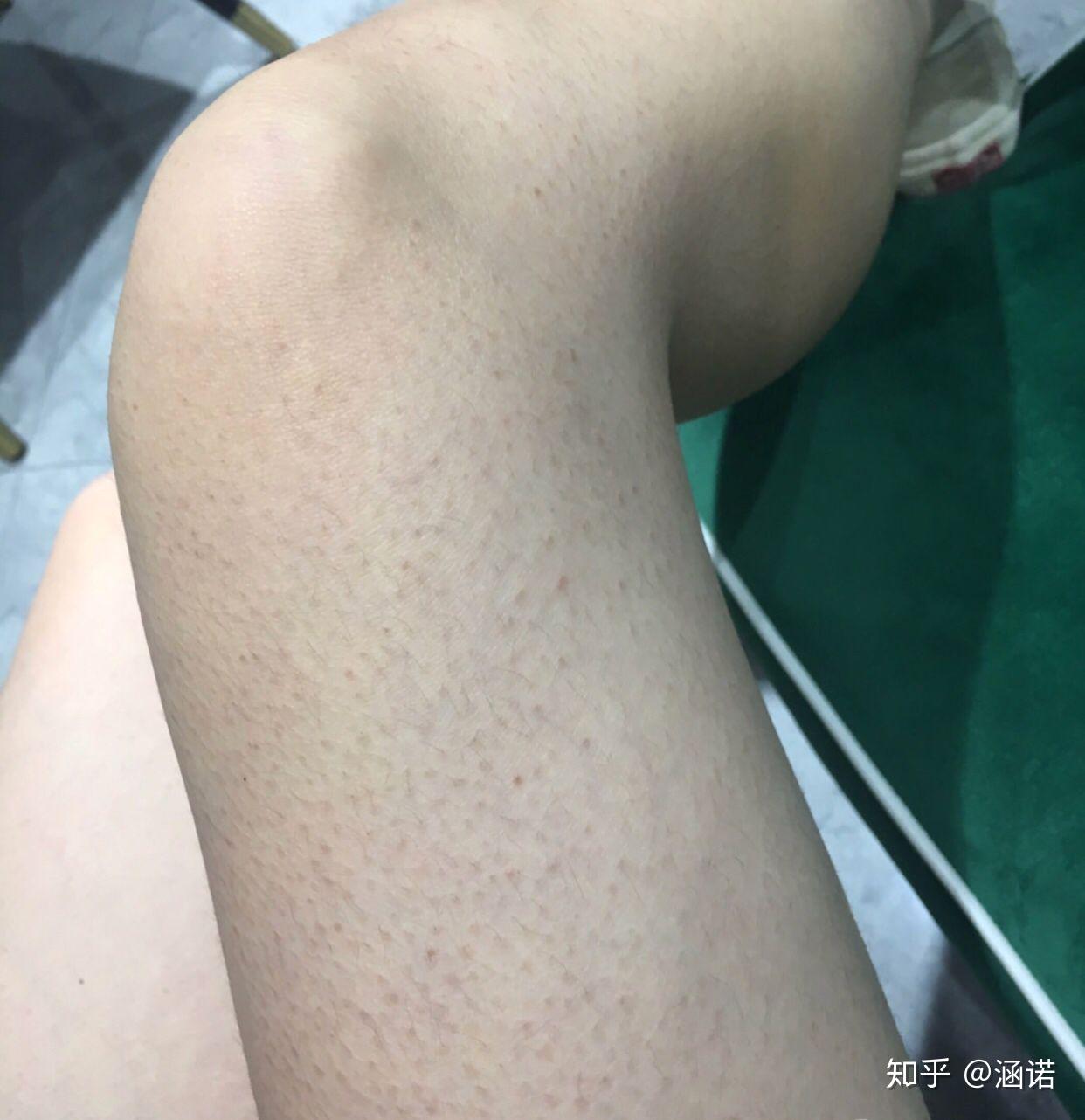 v2-972296e46db6b6609fc2b329e2cdfe5a_r.jpg