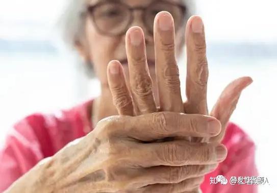 帕金森如何判断自己现在到第几阶段