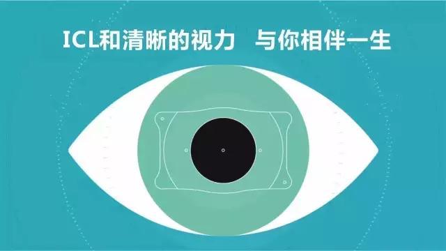 2分钟了解icl V4c晶体植入手术 知乎 2分钟了解icl V4c晶体植入手术 知乎