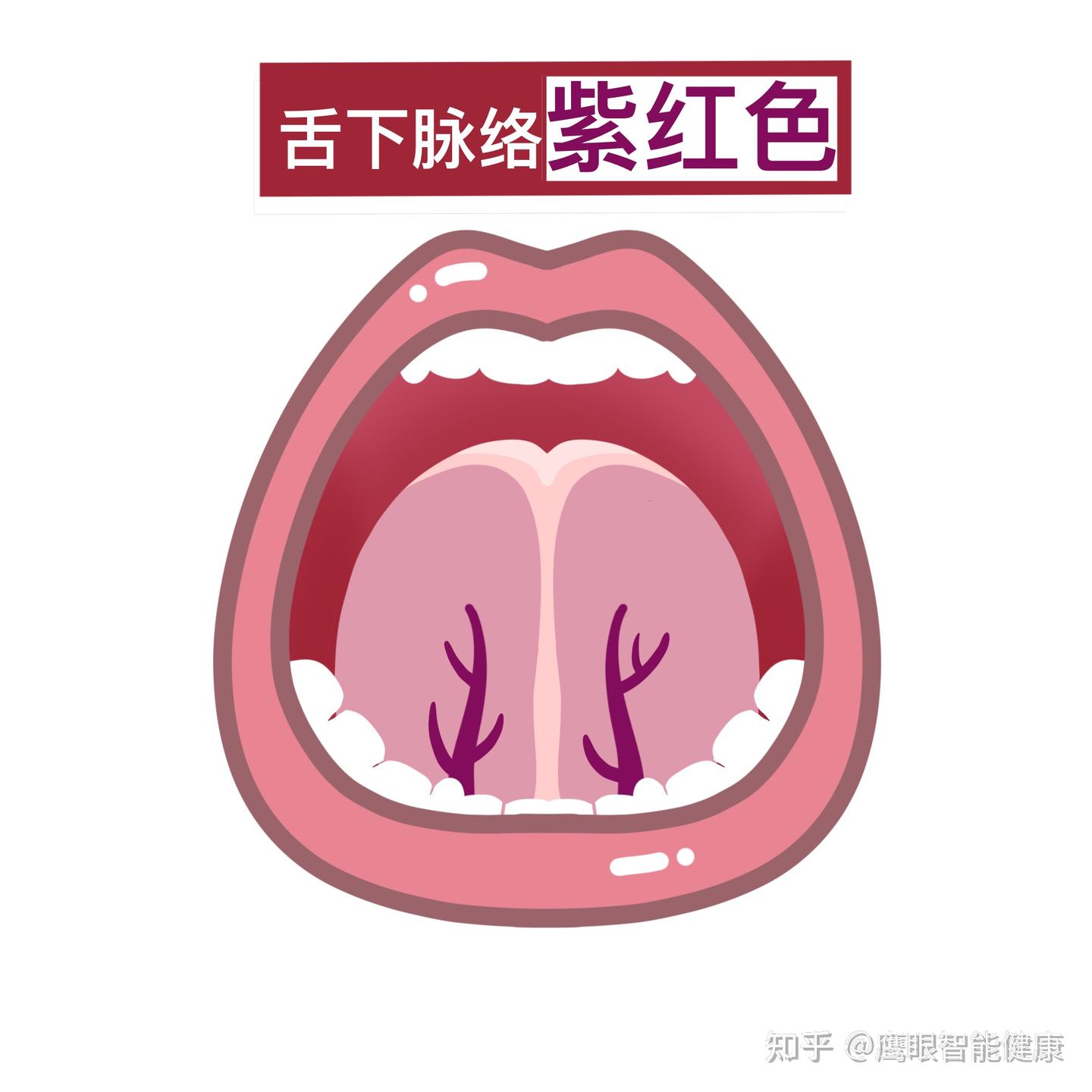 中医看舌底是看的什么?教你一招,轻松判断身体状况 - 知乎