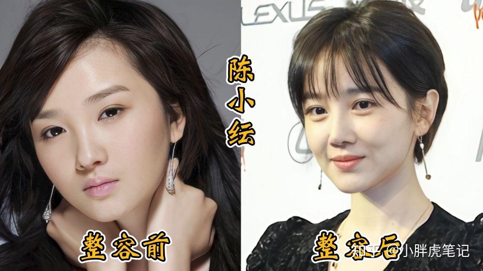 18位女明星整容前后对比，邵音音面目全非，杨颖堪称整容模板！ - 知乎