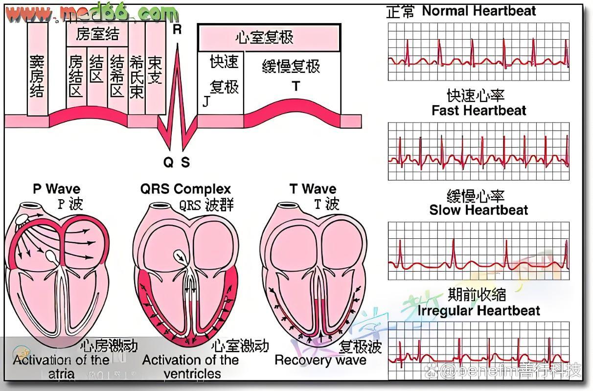 心脏早搏是什么意思图片