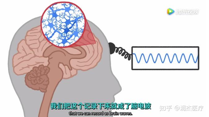 为什么脑电生物反馈训练要采集前额叶皮层的脑电信号？ - 知乎