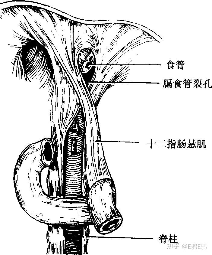 诊断学-症状学-呕血与便血 - 知乎