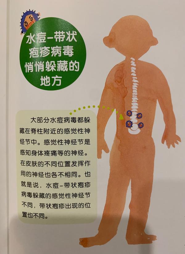 「水痘」发病原因是什么,出水痘有哪些症状,如何护理?