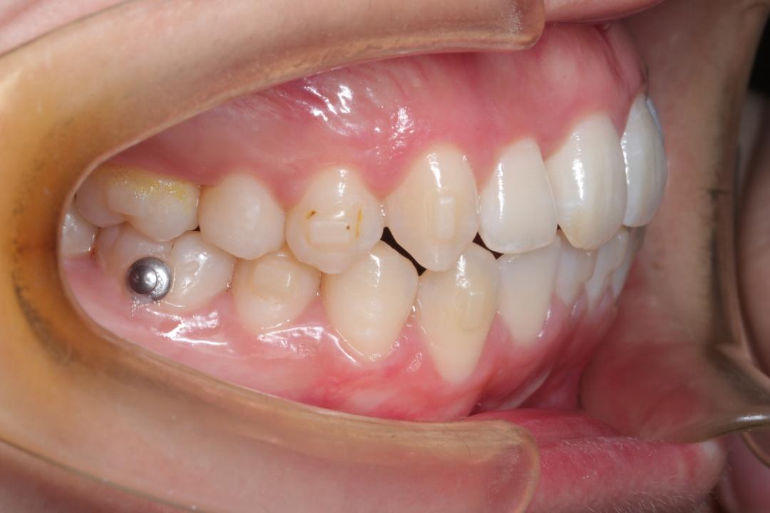 口腔医生须知资料收集正畸患者摄影资料的采集